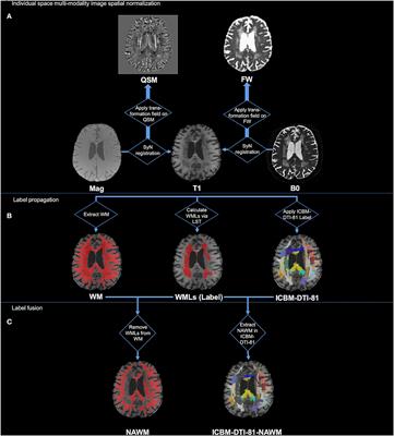 Characterization of white matter over 1–2 years in small vessel disease using MR-based quantitative susceptibility mapping and free-water mapping